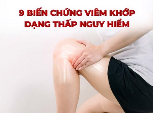 Cảnh giác 9 biến chứng viêm khớp dạng thấp vô cùng nguy hiểm